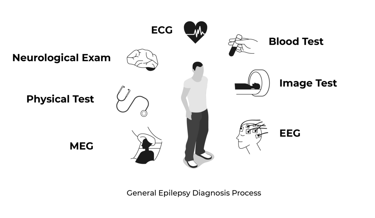 ways to diagnose epilepsy
